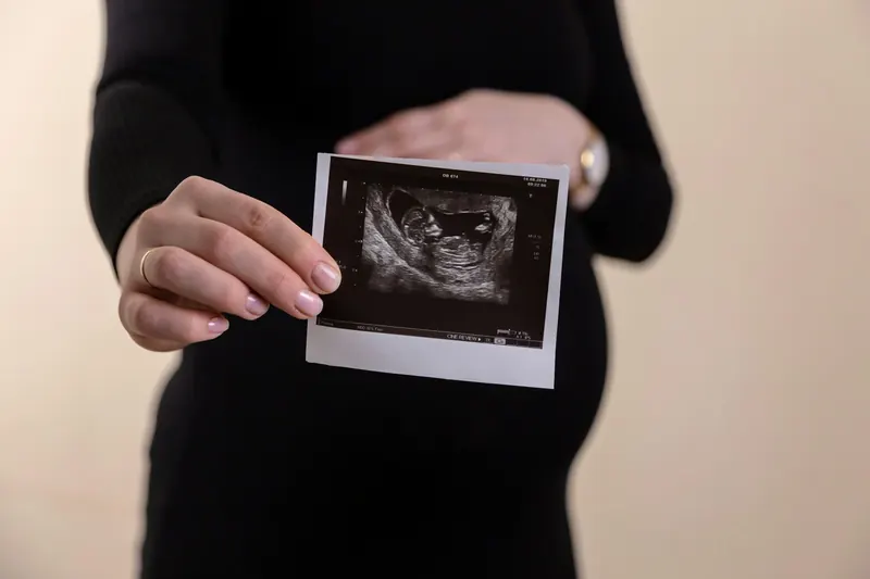 Pregnant woman in a black dress holding up a printed ultrasound image